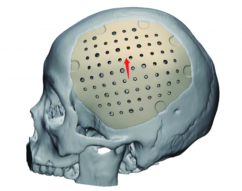 f0252c98-30a9-4157-9acb-11768adea065